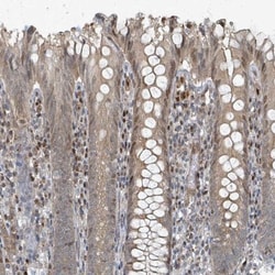 Rhophilin 2 Antibody, Novus Biologicals 0.1mL; Unlabeled:Antibodies, Polyclonal